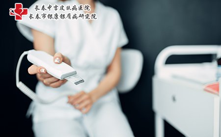 痤疮可以用激光治疗