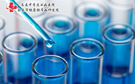 白癜风患者尽量不要接触化学物质